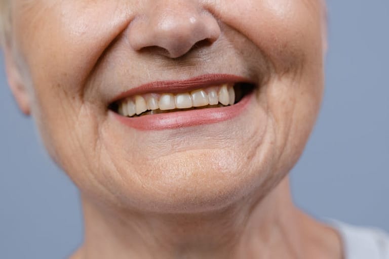 How To Whiten Teeth Naturally - Everything You Need To Know 4 Visual Representation Of How To Whiten Teeth Naturally Everything You Need To Know