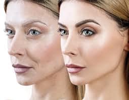 How Nmn Affects Skin Health &Amp; Anti-Aging Benefits 1 Nmn Anti Aging